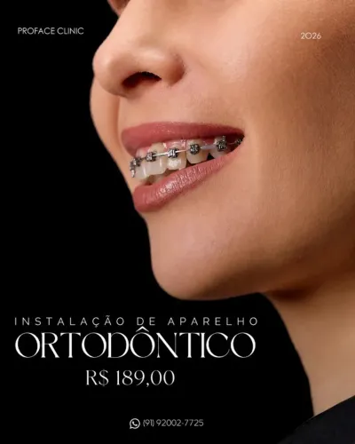 APARELHO ORTODONTICO