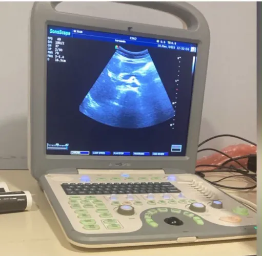 Aparelho de ultrassom portátil