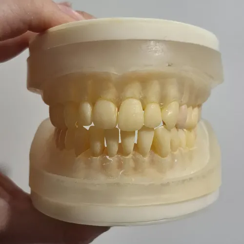 Refil Manequim Periodontia Pronew Usado