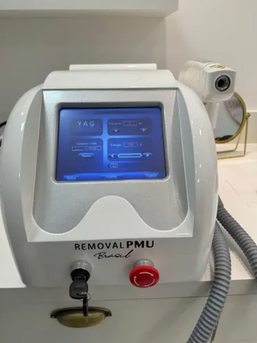 Laser de remoção nd yag