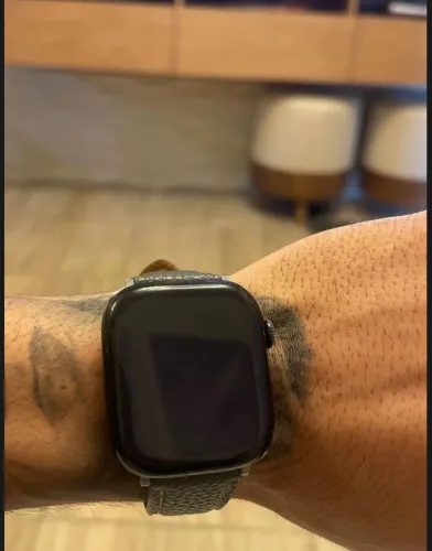 Apple Watch Series 10