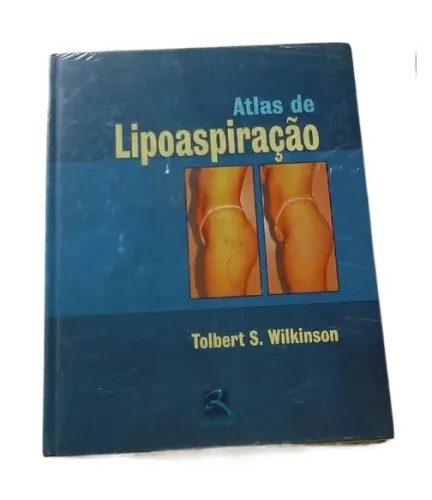 Livro - Atlas De Lipoaspiração - Wilkinson