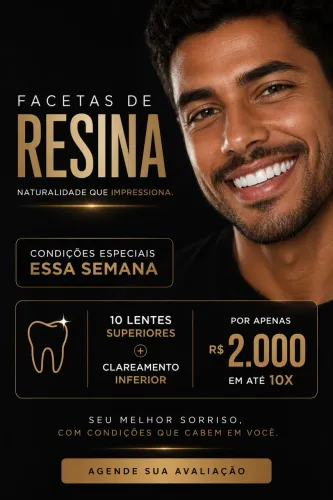 Facetas de resina