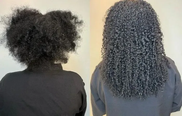  Implantista profissional a domicilio