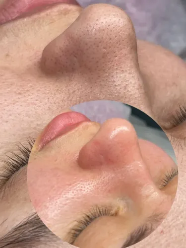 Modelo Limpeza de Pele, Extensão de Cilios e Sobrancelhas 