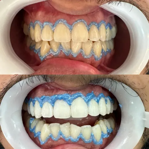 Serviços odontológicos no engenho novo