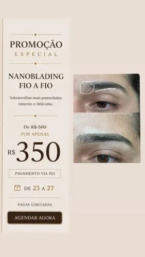Nanoblading fio a fio
