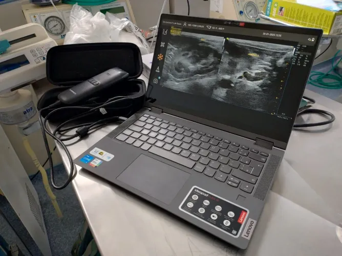 Ultrassom Portátil Vinno Q: Transdutor Linear + Notebook Lenovo Touchscreen
