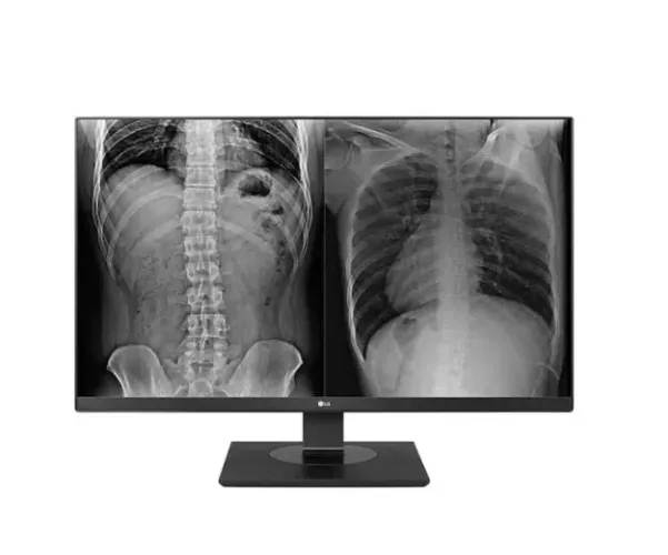 Monitor LG de diagnóstico para Raio X e Computação 