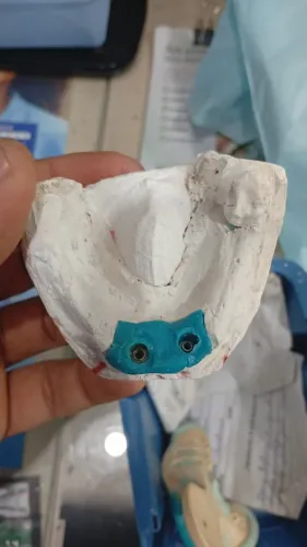 Laboratório de Prótese Dentária