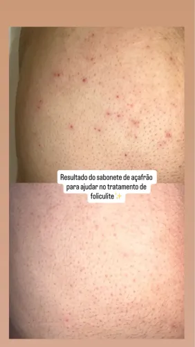 Sabonete de açafrão e de clareamento 