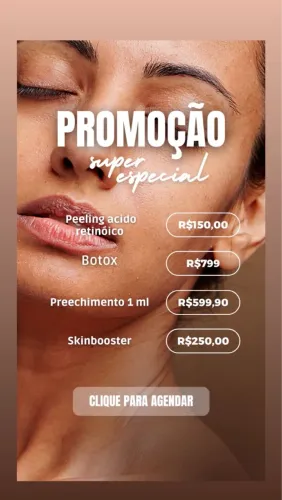 Harmonização Facial 