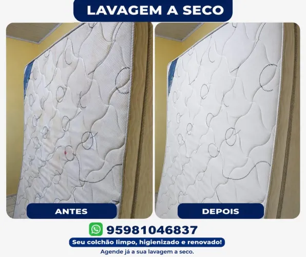 Camas- lavagem a seco