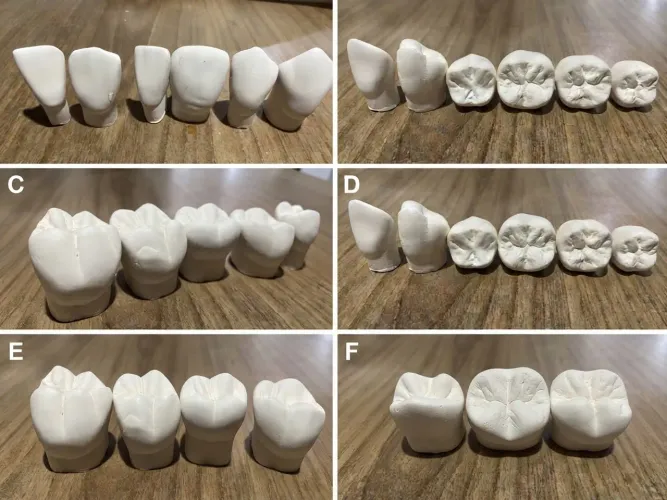 Modelos Anatómicos de Dentes em Gesso - Para Estudo / Prática (Medicina Dentária)
