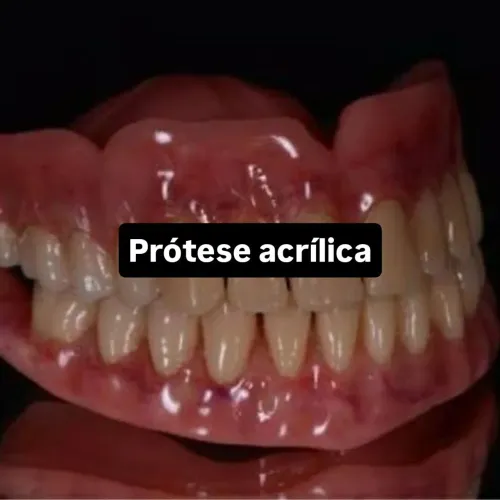 Técnico De Prótese dentária