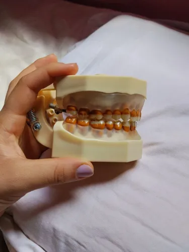 manequim de periodontia padrão - marca orais