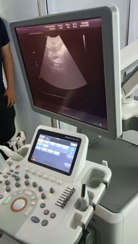 Ultrassom Medison Accuvix XG - Completo e Excelente Qualidade de Imagem
