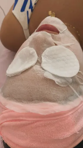 Limpeza de pele profunda e tratamento de Acne