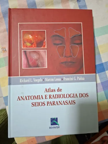 Atlas de Anatomia e Radiologia dos Seios Paranasais.