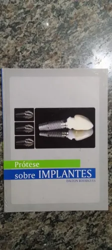 Estudo avançado da Implantodontia!