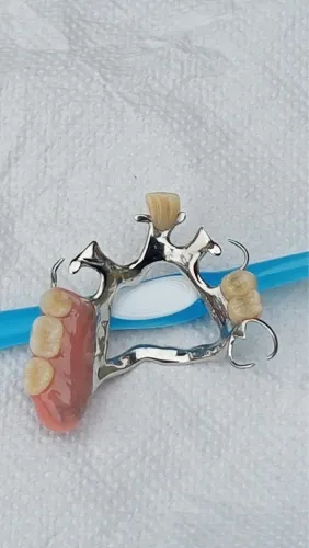 Prótese dentária