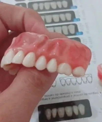 Prótese dentária 
