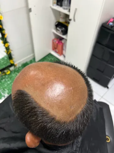 PRÓTESES CAPILARES/ LACES CABELO HUMANO 