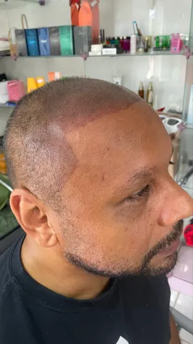 Fios 4D realista micropigmentação capilar 499,00