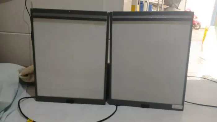 Dois Negatoscópios para Parede Metal Branco