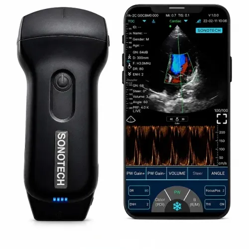 ULTRASSOM PORTÁTIL SONOTECH