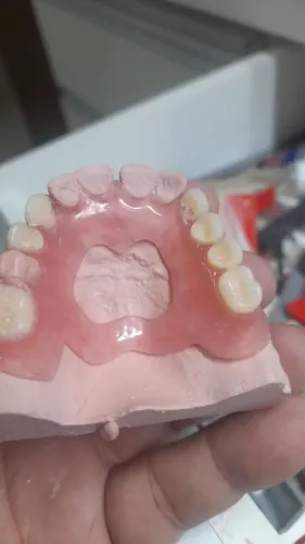 Prótese Dentária 