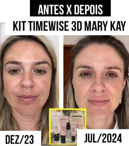 Kit Timewise Marykay