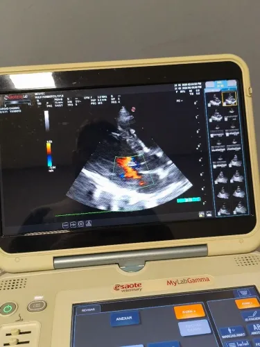 Aparelho de ultrassom e ecocardiografia veterinária marca Esaote modelo Mylab Gamma 2016