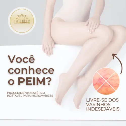 Tratamento para microvarizes