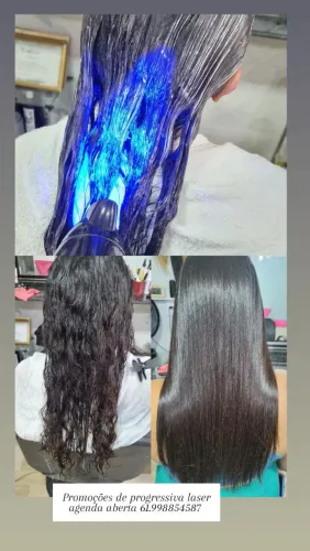 Alisamento progressivo a laser