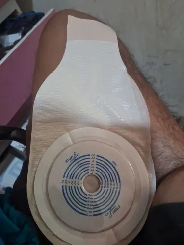 Bolsa de colostomia