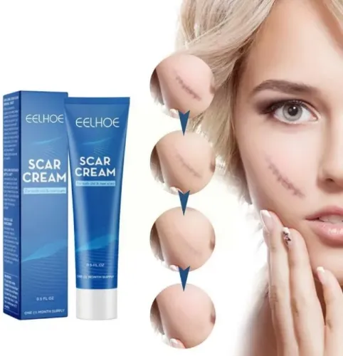 2Un. EELHOE Creme De Cicatrizes 15g