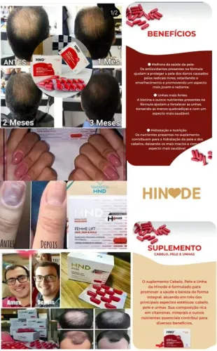 Cabelo, Pele e unha Caixa dura 2 meses