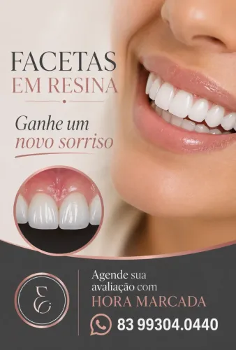 FACETAS EM RESINA - TRANSFORME SEU SORRISO COM NATURALIDADE E ALTO PADRÃO