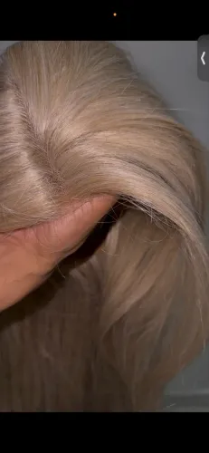 Lace Front 1 Metro
