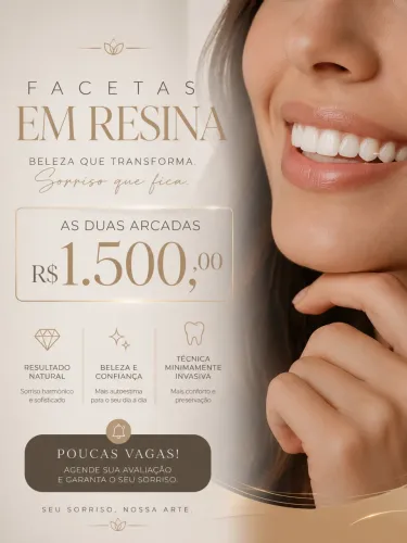 Facetas em resina