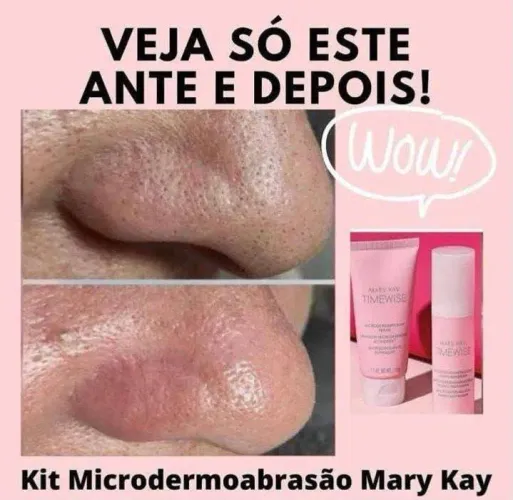 Kit microdermoabrasão ,menos poros dilatados e cravos!