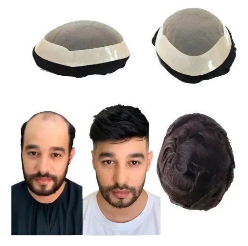 Prótese Capilar Masculina Híbrida