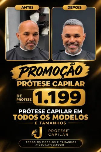 Prótese capilar instalada
