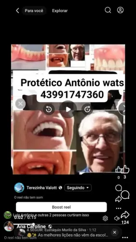 Protetico dentário pontes e 6Antônio