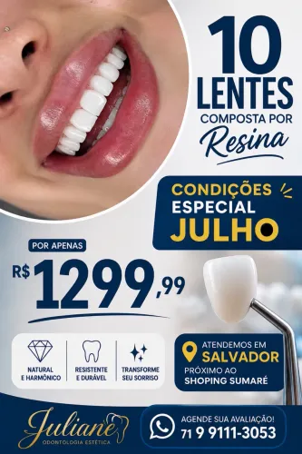 Faceta composta por resina premium