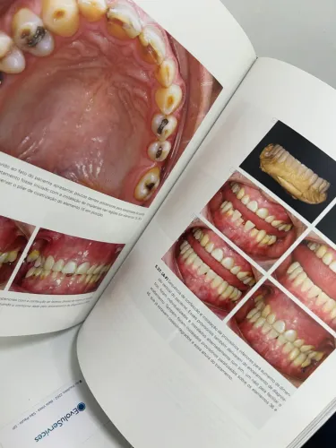 Livro de Odontologia - implantes