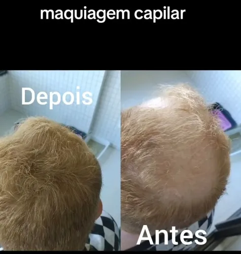 Fibra capilar cobre as falhas em minutos 
