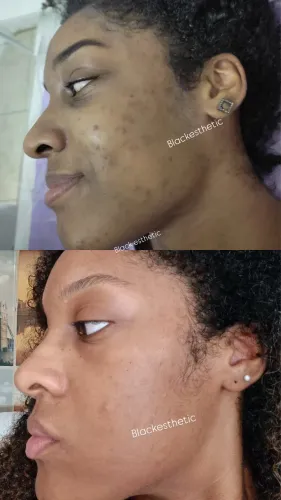 Tratamentos de estética personalizado 