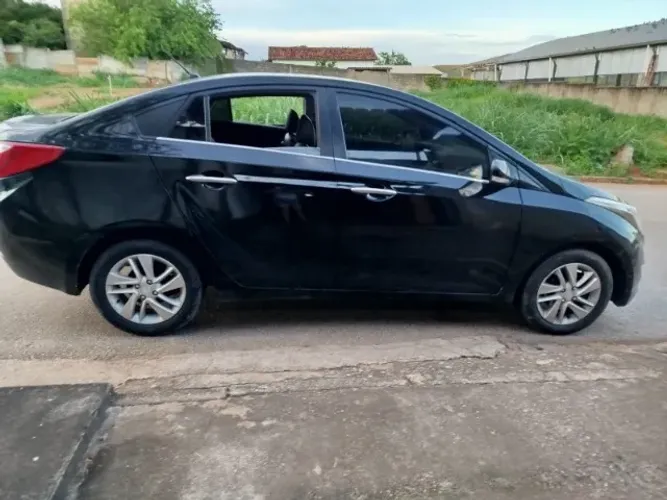 Hyundai HB20S Premium 1.6 Flex 16V Aut. 4P 2015